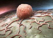 4 Şubat Dünya Kanser Günü | “Bölgesel eşitsizlik kanser tedavisinde önemli etken”