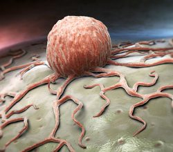 4 Şubat Dünya Kanser Günü | “Bölgesel eşitsizlik kanser tedavisinde önemli etken”