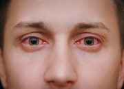 Kalıcı Hasar Bırakıyor: Kırmızı Göz Salgını!